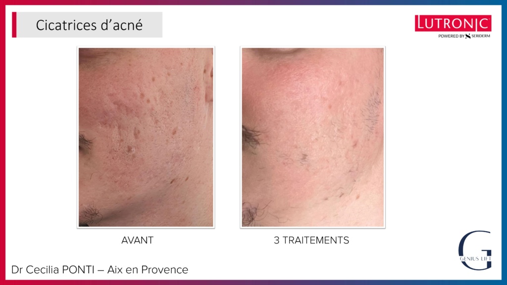 Cas Cliniques GENIUS + LASEMD & ULTRA_page-0016 Cas Cliniques GENIUS + LASEMD & ULTRA_page-0016