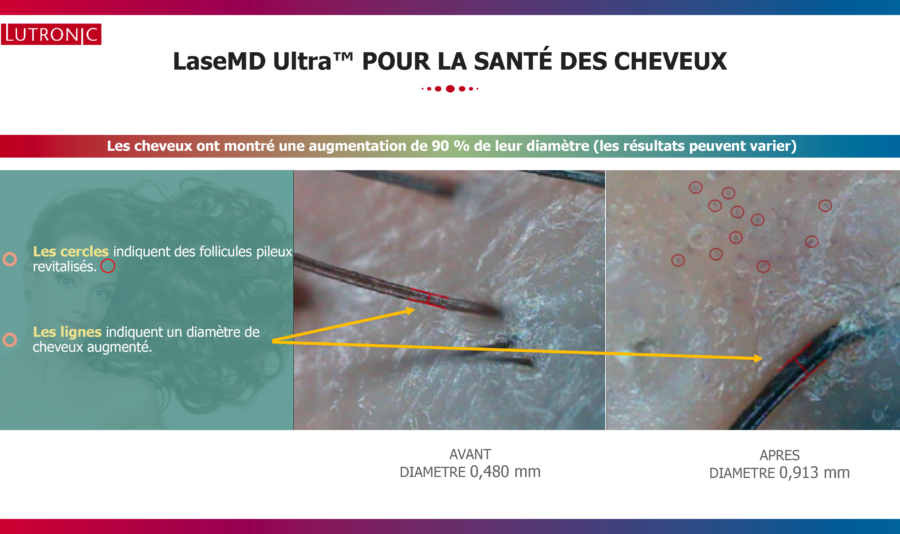 KERAFACTOR présentation clinique -6