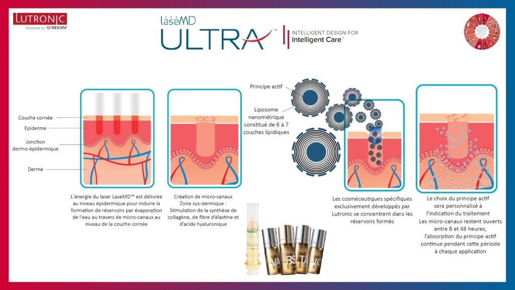 Présentation LaseMD Ultra_page-0004 Présentation LaseMD Ultra_page-0004