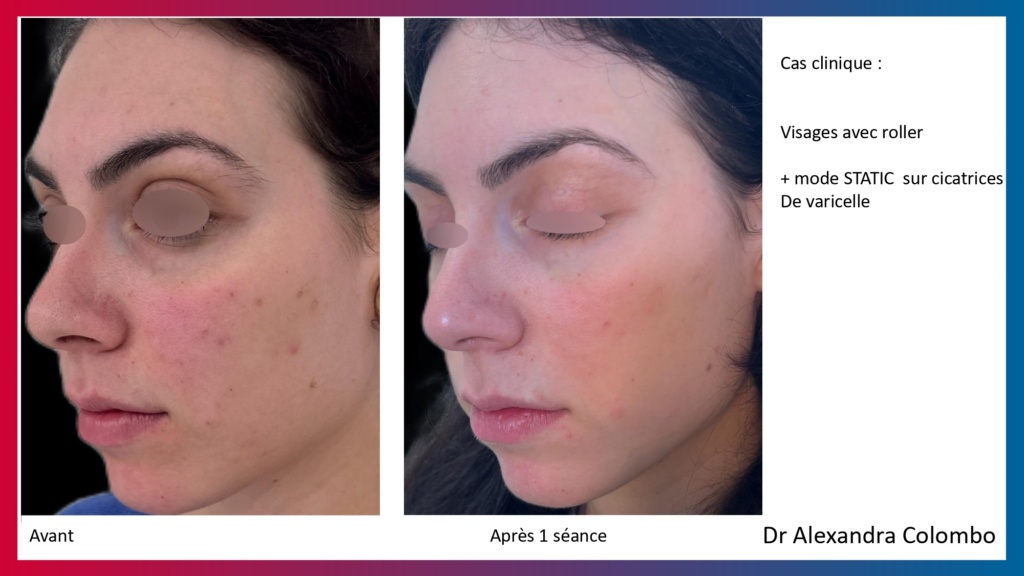 Présentation LaseMD Ultra_page-0024 Présentation LaseMD Ultra_page-0024